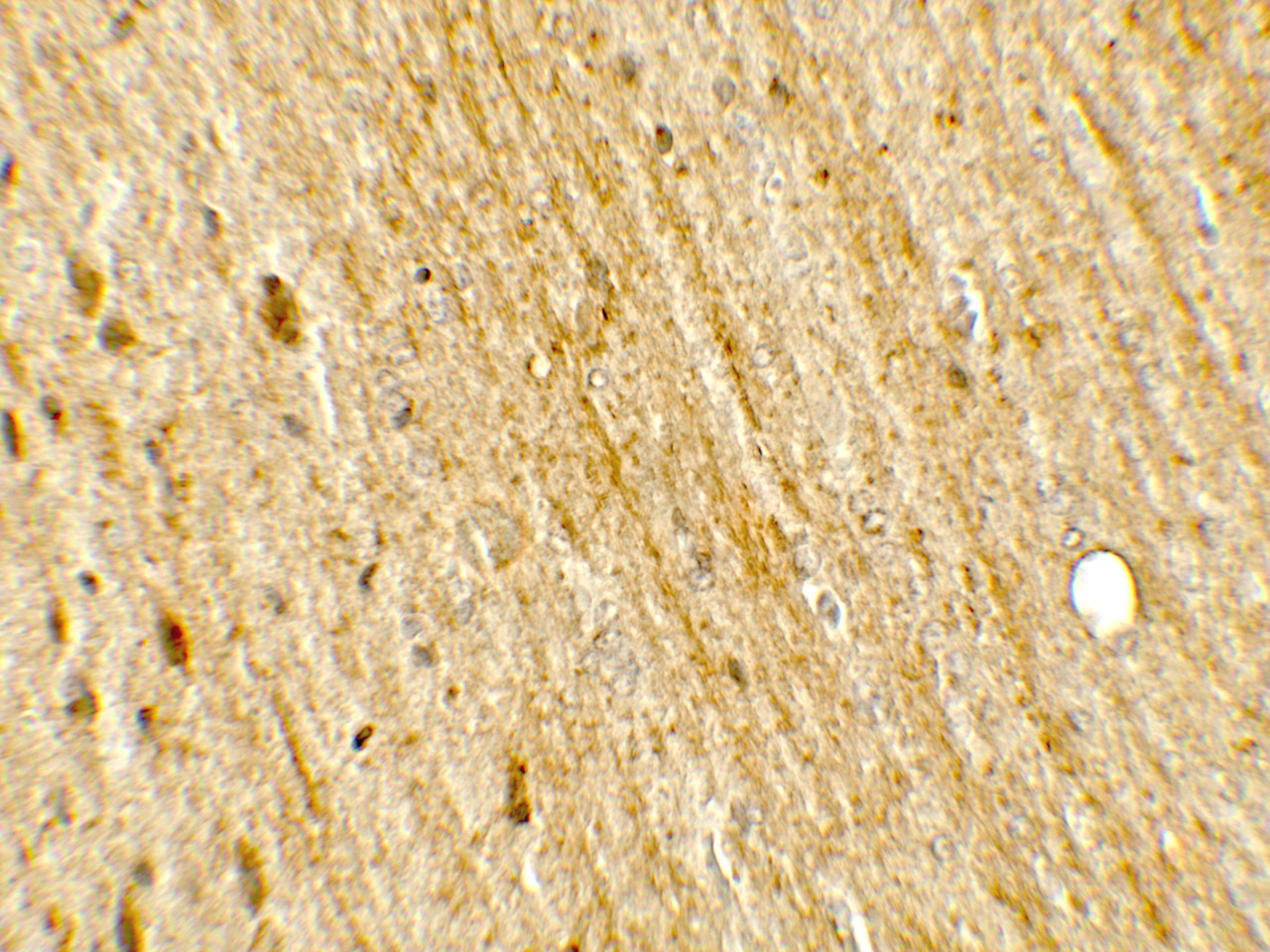 Immunohistochemistry of POU2F3 in rat brain tissue with POU2F3 antibody at 5 ug/mL.