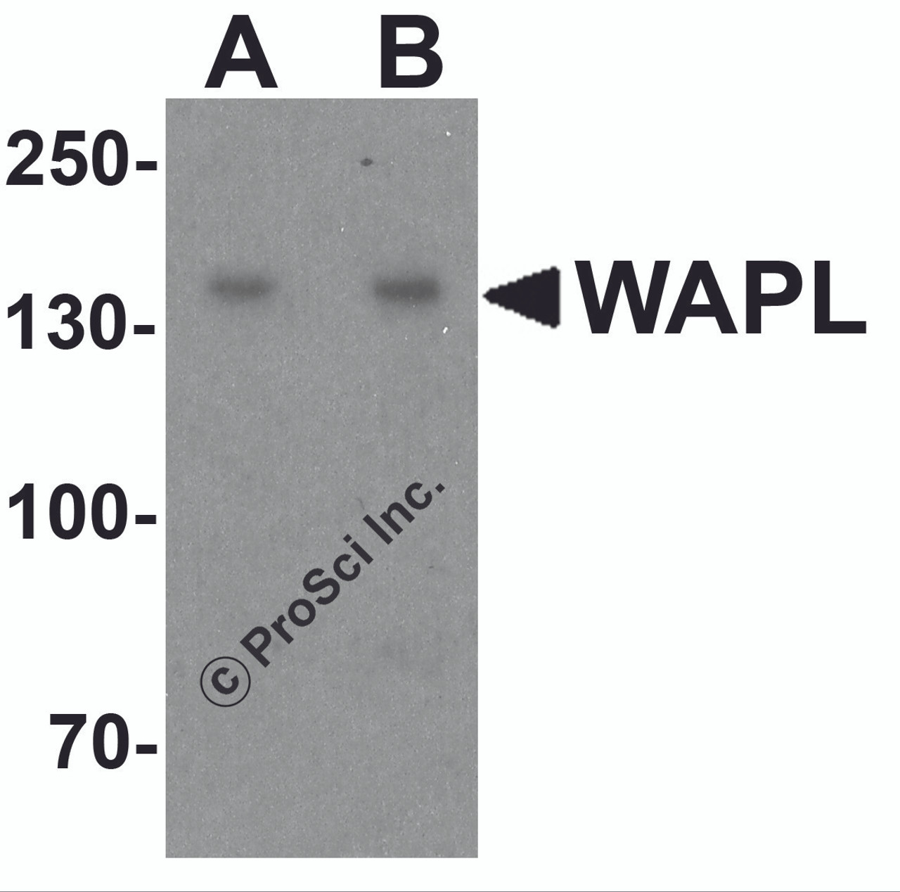 Western blot analysis of WAPL in A20 cell lysate with WAPL antibody at (A) 1 and (B) 2 &#956;g/ml.