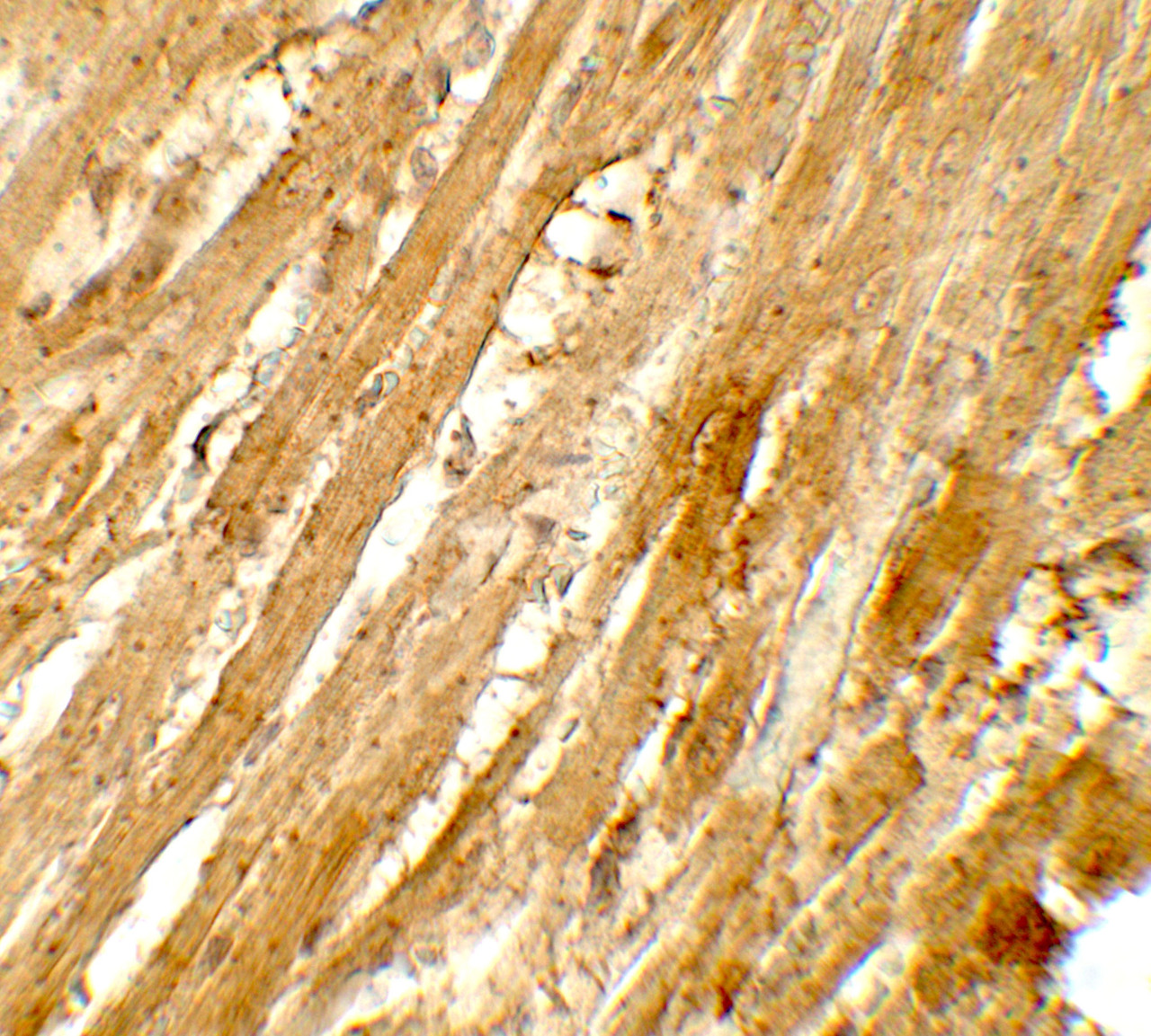 Immunohistochemistry of WAPL in rat heart tissue with WAPL antibody at 5 ug/mL.