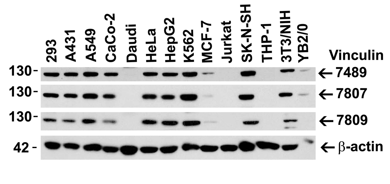 Figure 1 Independent Antibody Validation (IAV) via Protein Expression Profile in Human, Mouse and Rat Cell Lines
Loading: 15 &#956;g of lysates per lane.
Antibodies: Vinculin 7489 (2 &#956;g/mL) , Vinculin 7807 (1 &#956;g/mL) , Vinculin 7809 (1 &#956;g/mL) , and beta-actin 3779 (1.5 &#956;g/mL) , 1h incubation at RT in 5% NFDM/TBST.
Secondary: Goat anti-rabbit IgG HRP conjugate at 1:10000 dilution.