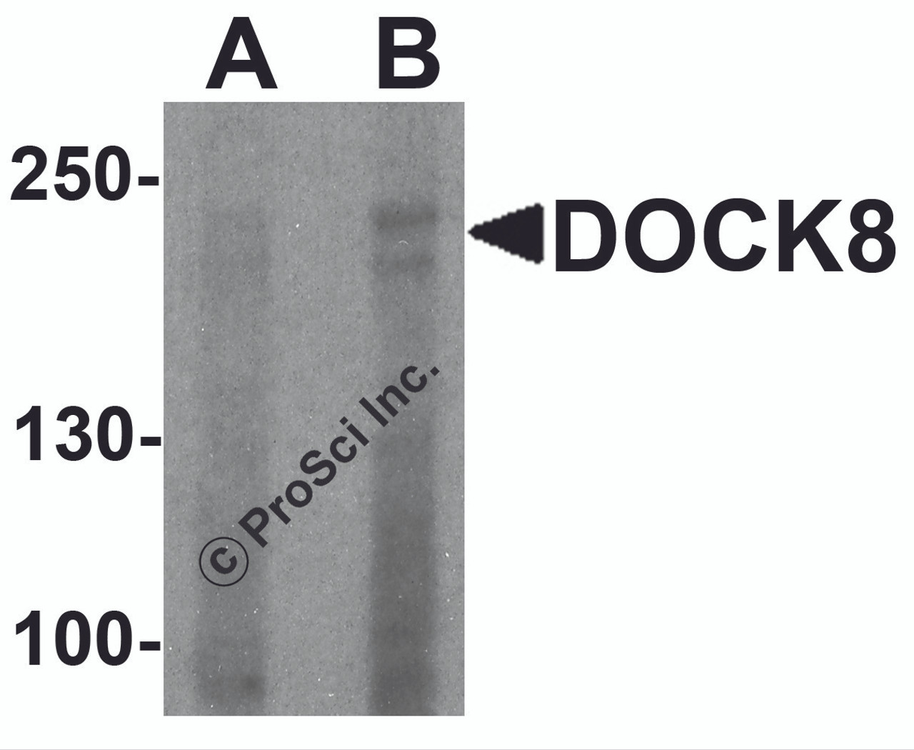 Western blot analysis of DOCK8 in EL4 cell lysate with DOCK8 antibody at (A) 1 and (B) 2 &#956;g/ml.