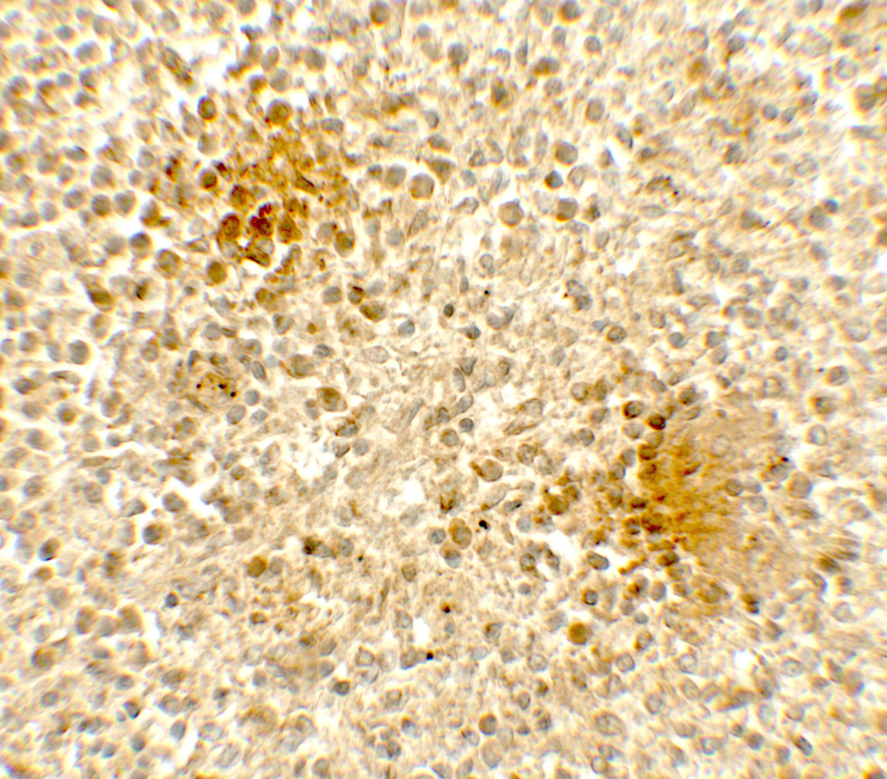 Immunohistochemistry of DOCK8 in human spleen tissue with DOCK8 antibody at 5 ug/mL.