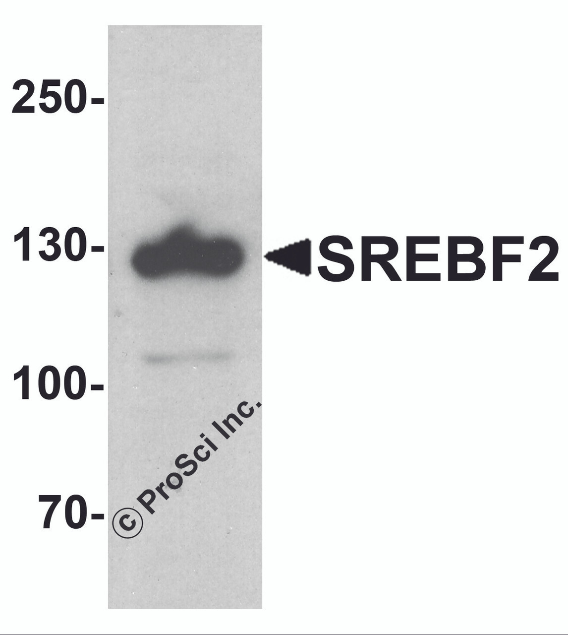 Western blot analysis of SREBF2 in PC-3 cell lysate with SREBF1 antibody at 1 &#956;g/ml.