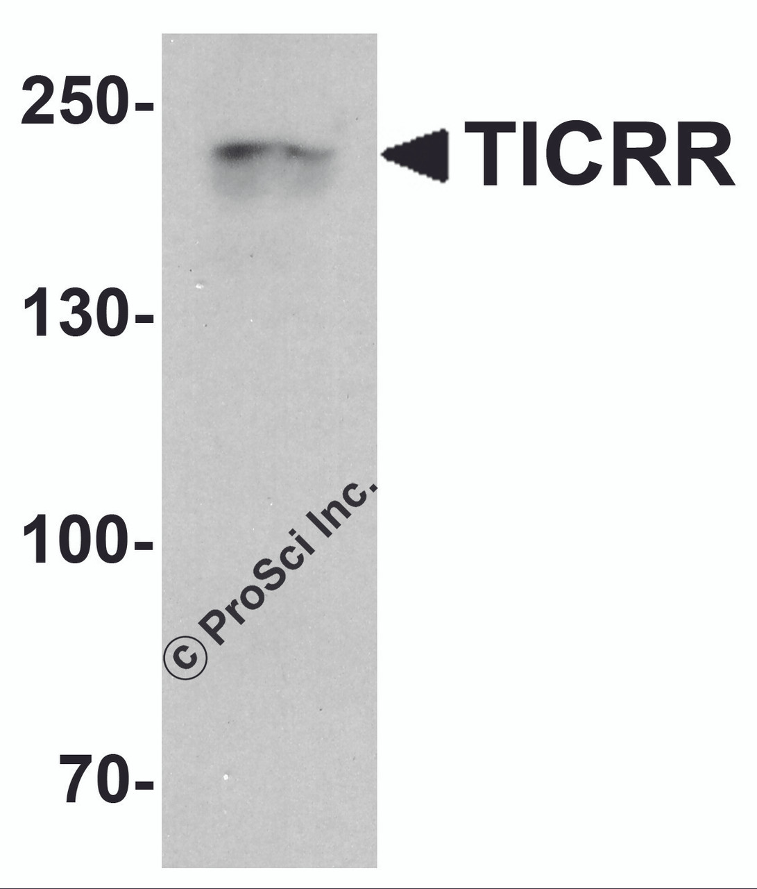 Western blot analysis of TICRR in human small intestine tissue lysate with TICRR antibody at 1 &#956;g/ml.