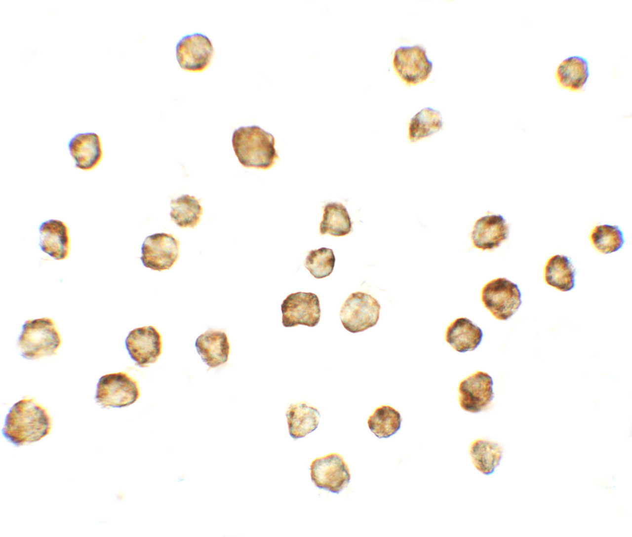 Immunocytochemistry of MFN1 in A431 cells with MFN1 antibody at 5 ug/mL.