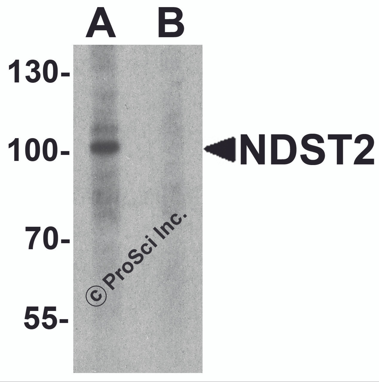 Western blot analysis of NDST2 in A-20 cell lysate with NDST2 antibody at 1 &#956;g/ml in (A) the absence and (B) the presence of blocking peptide.