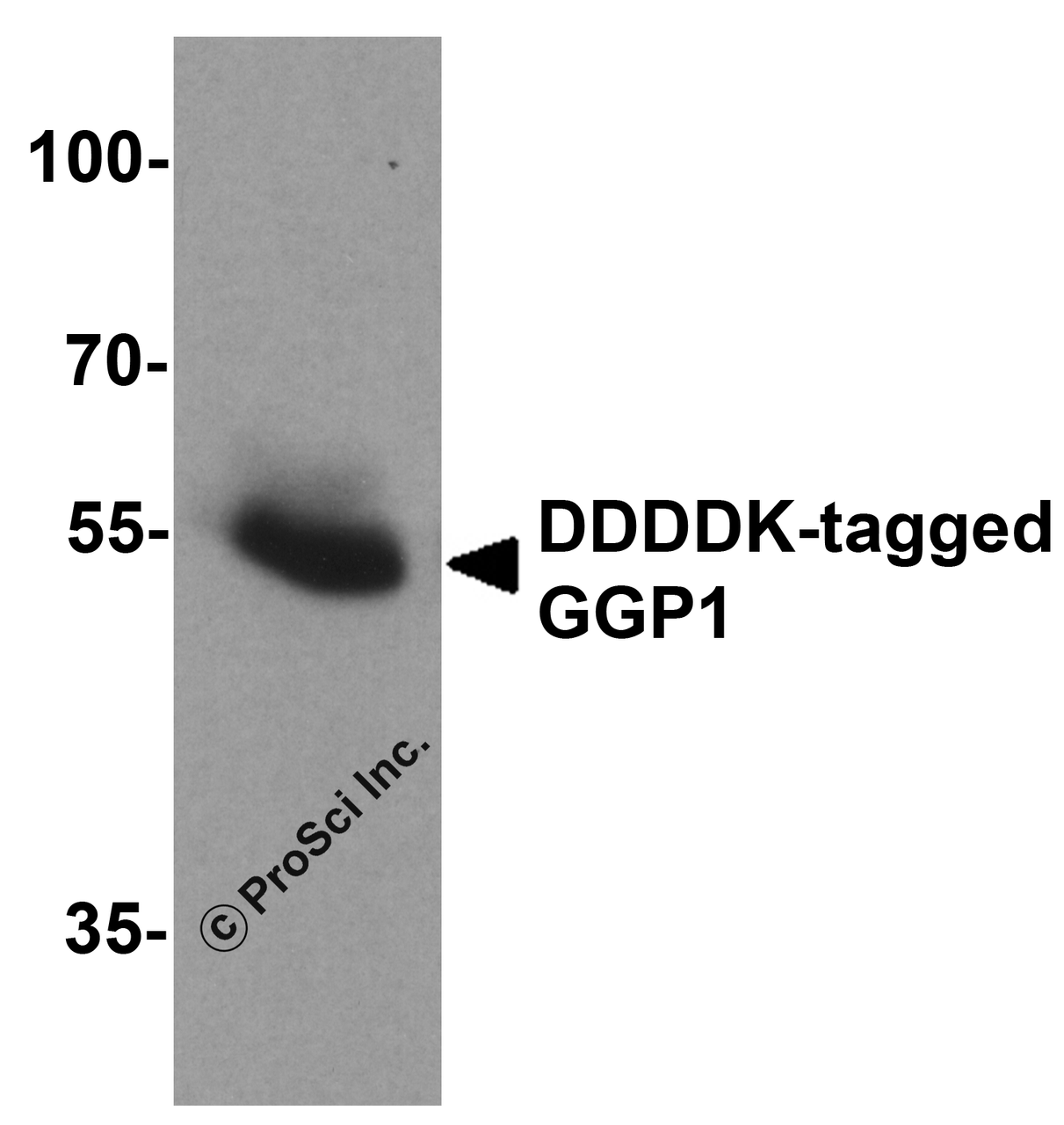 Western blot analysis of 20ng of DDDDK-tagged recombinant GGP1 protein using 1 ug of DDDDK antibody to immunoprecipitate and 1 ug/ml anti-GGP1 antibody to detect.