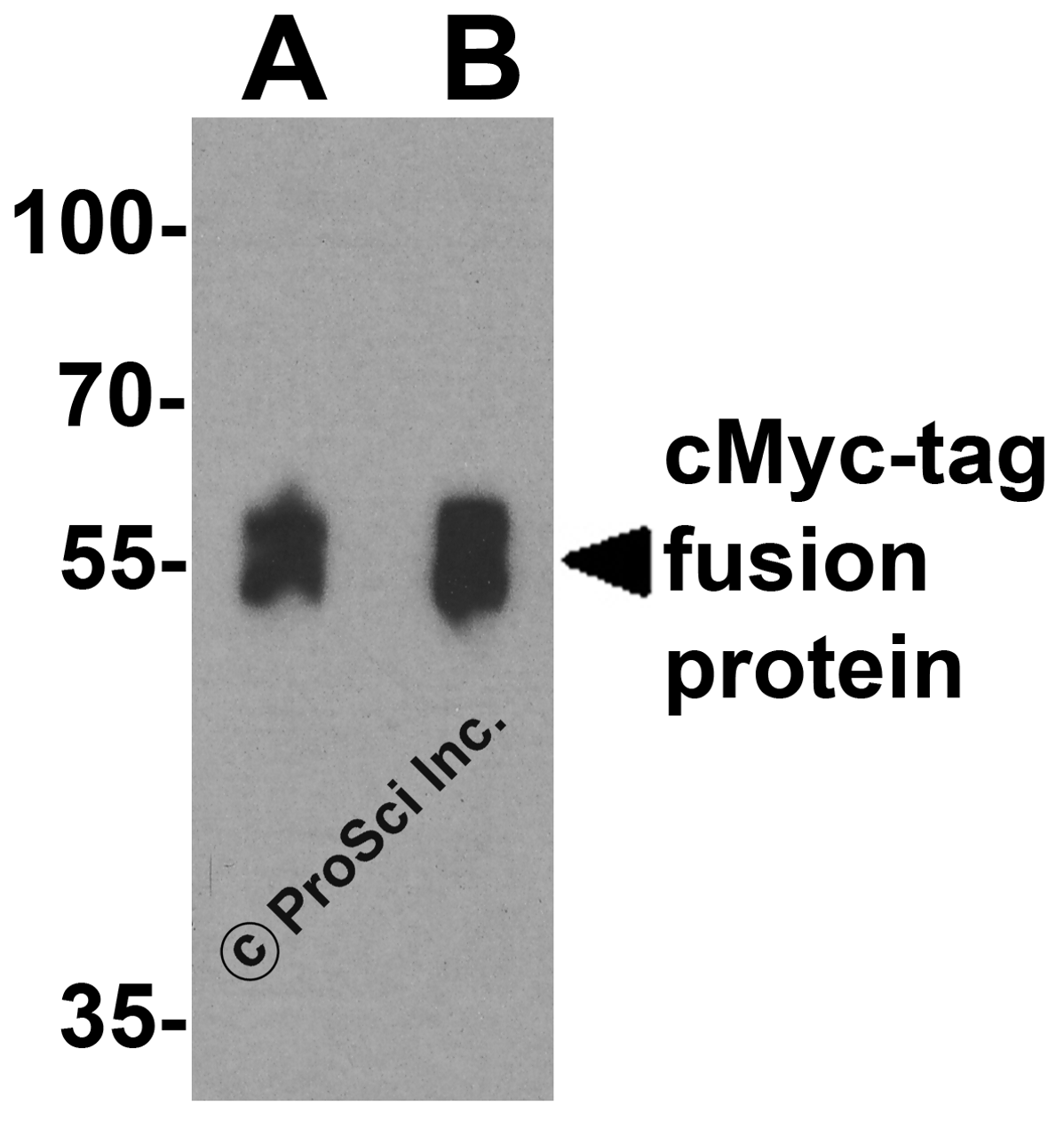 Western blot analysis of a cMyc-tag-containing recombinant protein with cMyc-tag antibody at (A) 0.125 and (B) 0.25 &#956;g/ml.
