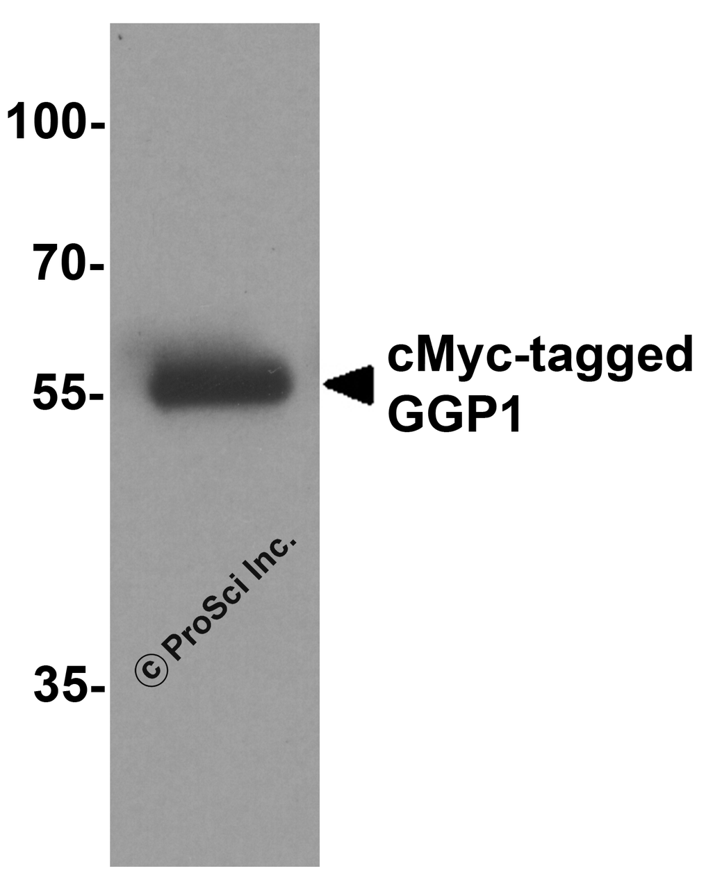 Western blot analysis of 20ng of cMyc-tagged recombinant GGP1 protein using 1 ug of cMyc antibody to immunoprecipitate and 1 ug/ml anti-GGP1 antibody to detect.