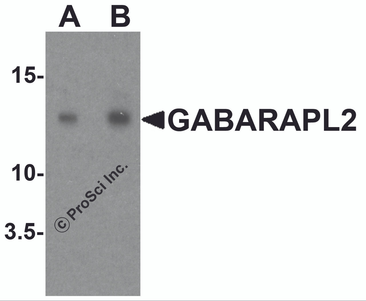 Western blot analysis of GABARAPL2 in human brain tissue lysate with GABARAPL2 antibody at (A) 1 and (B) 2 &#956;g/ml.