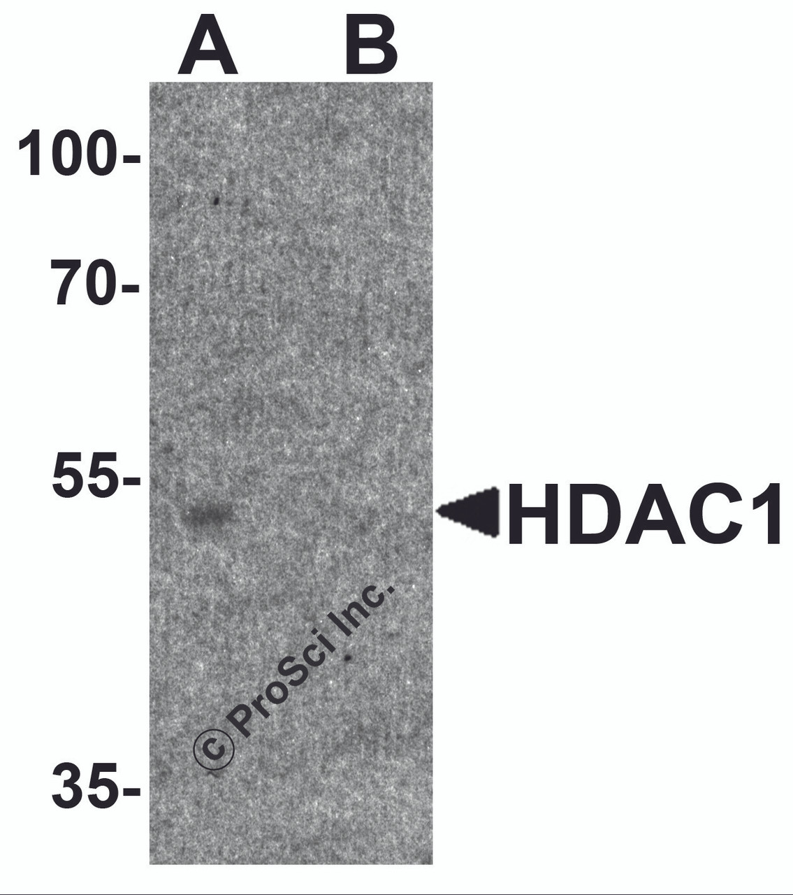 Western blot analysis of HDAC1 in human brain tissue lysate with HDAC1 antibody at 1&#956;g/ml in (A) the absence and (B) the presence of blocking peptide.