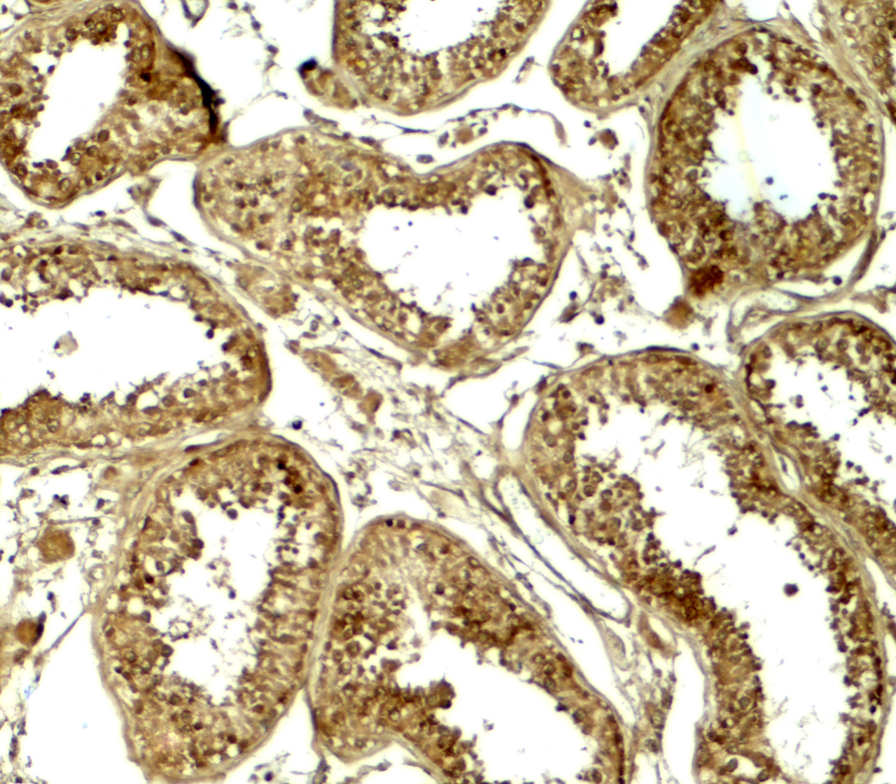 Immunohistochemistry of HDAC6 in human testis tissue with HDAC6 antibody at 5 ug/ml.