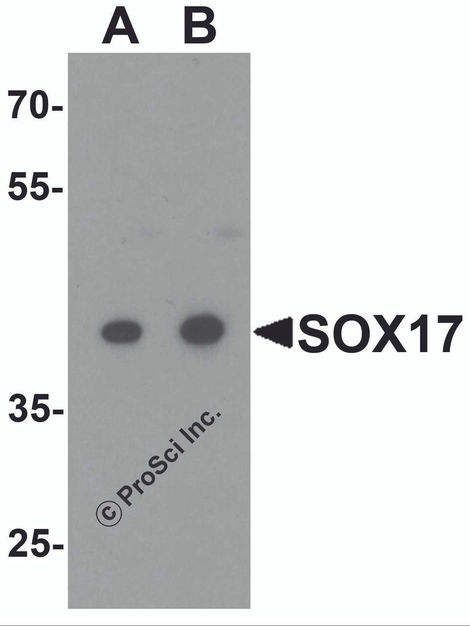 Western blot analysis of SOX17 in HepG2 cell lysate with SOX17 antibody at (A) 0.5 and (B) 1 &#956;g/ml.
