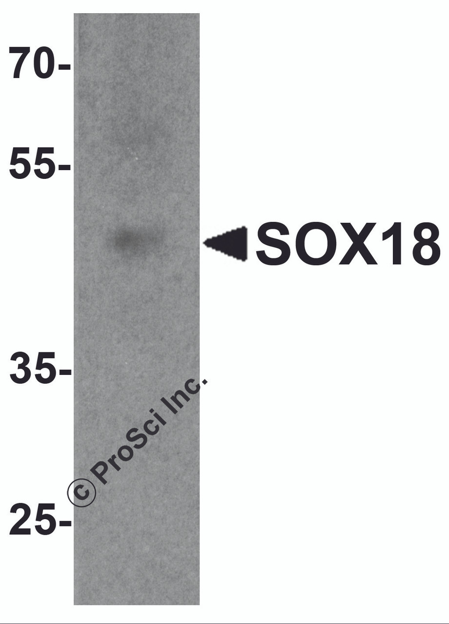 Western blot analysis of SOX18 in 3T3 cell lysate with SOX18 antibody at 1 &#956;g/ml.