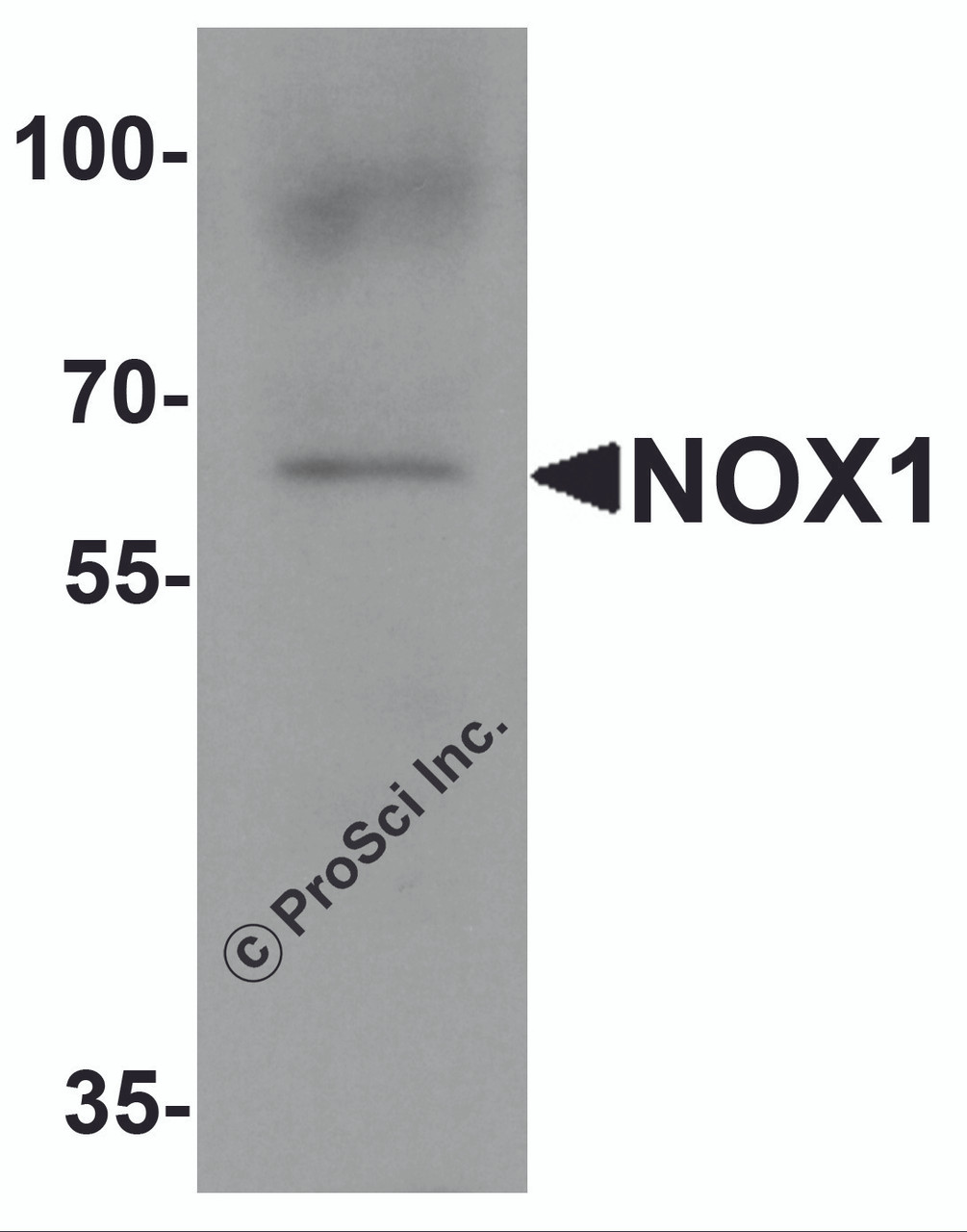 Western blot analysis of NOX1 in 293 cell lysate with NOX1 antibody at 1 &#956;g/ml.