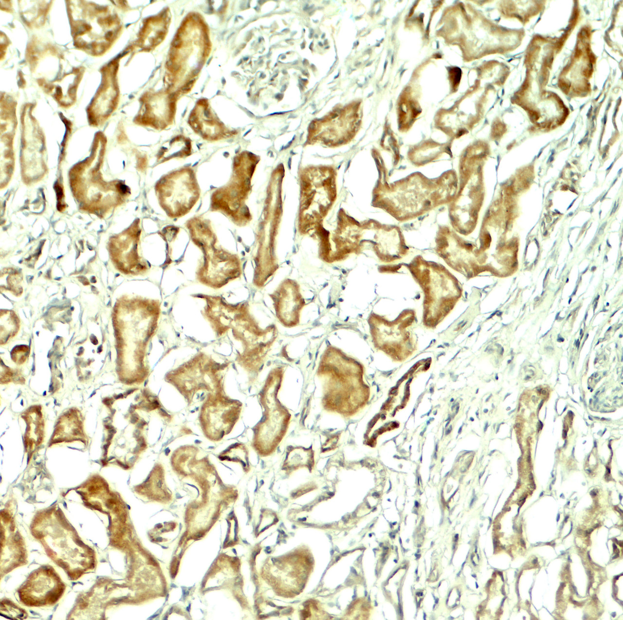 Immunohistochemistry of NOX1 in human kidney tissue with NOX1 antibody at 5 ug/ml.