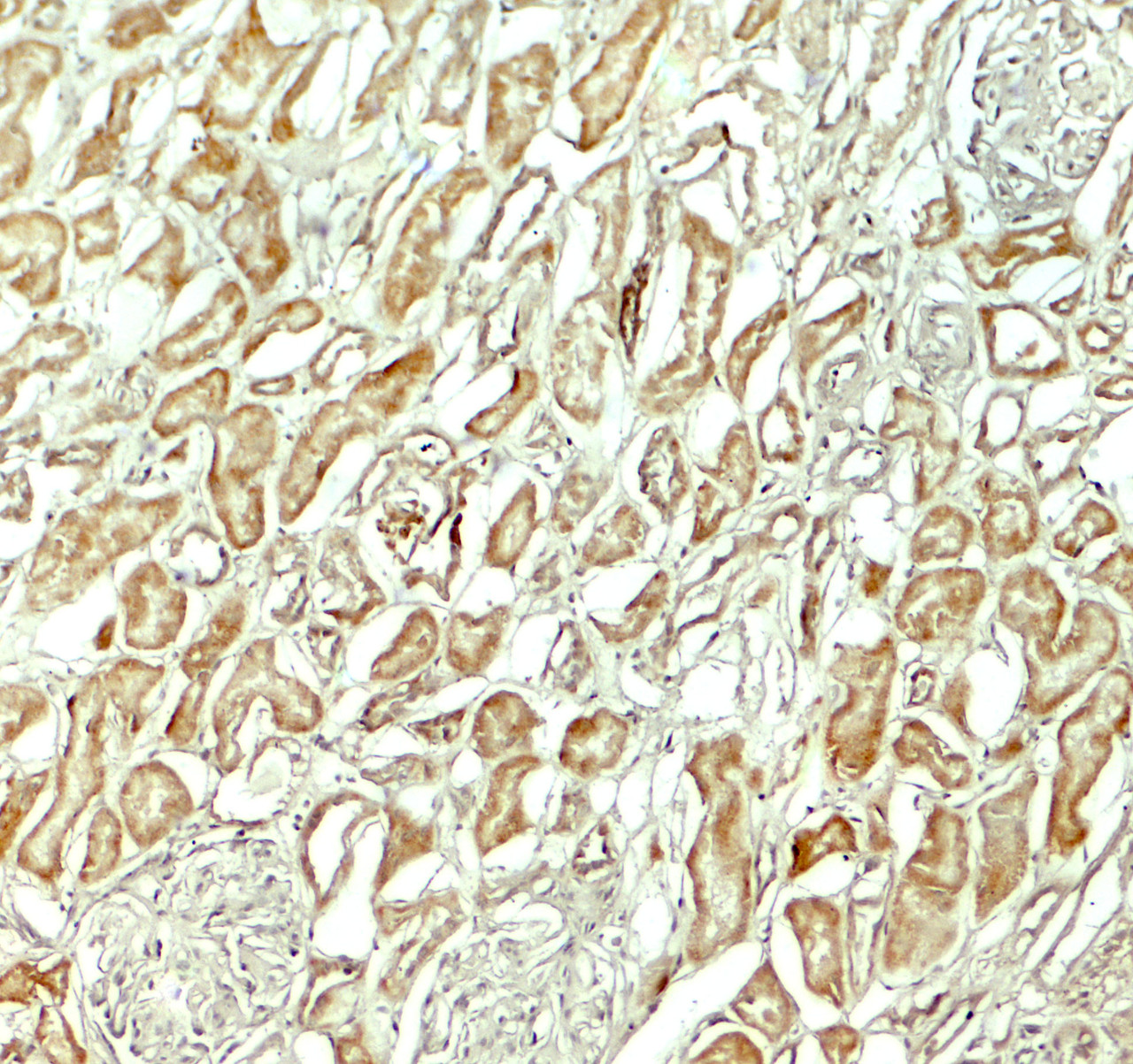 Immunohistochemistry of NOX3 in human kidney tissue with NOX3 antibody at 5 ug/ml.
