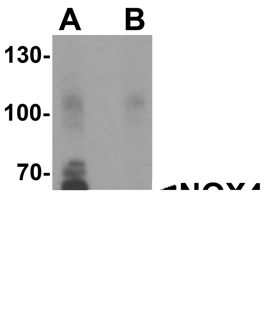Western blot analysis of NOX4 in Jurkat cell lysate with NOX4 antibody at 1 &#956;g/ml in (A) the absence and (B) the presence of blocking peptide.
