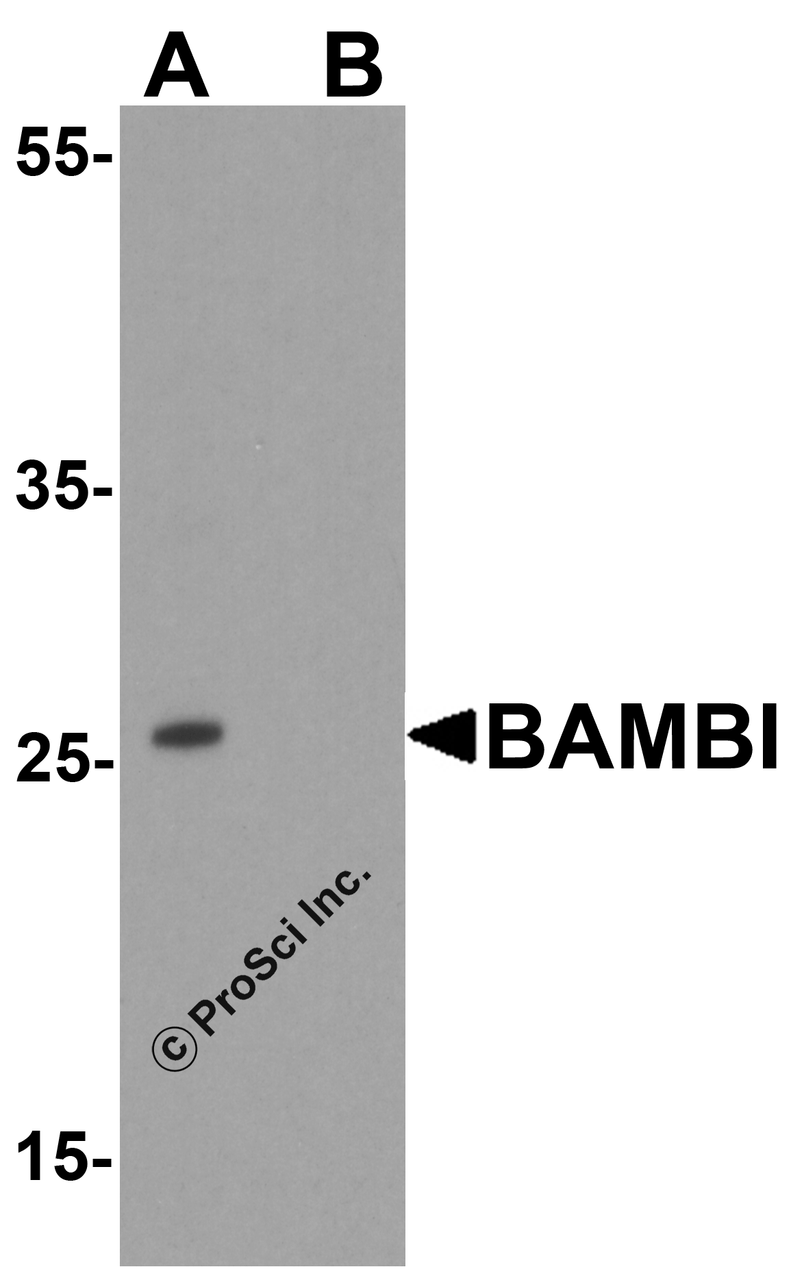 Western blot analysis of BAMBI in mouse lung tissue lysate with BAMBI antibody at 1 &#956;g/ml in (A) the absence and (B) the presence of blocking peptide.