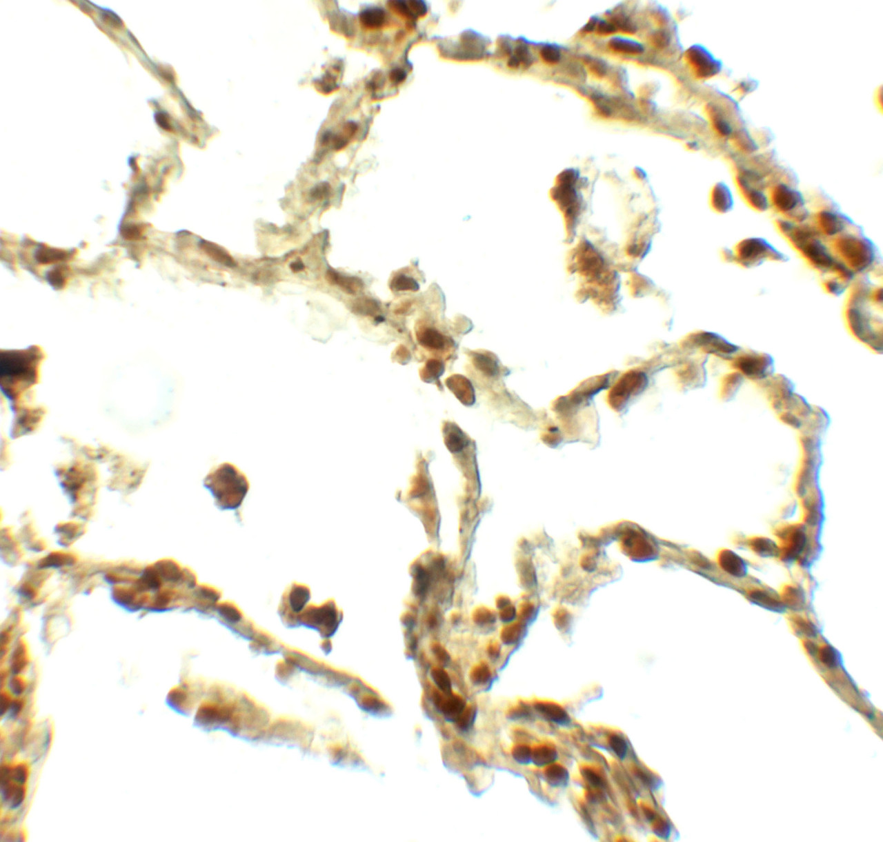 Immunohistochemistry of BAMBI in human lung tissue with BAMBI antibody at 5 ug/ml.