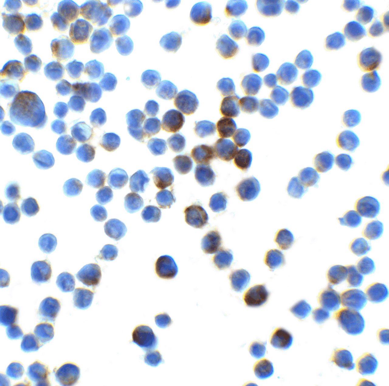 Immunocytochemistry of LIN54 in HeLa cells with LIN54 at 2.5 ug/mL.