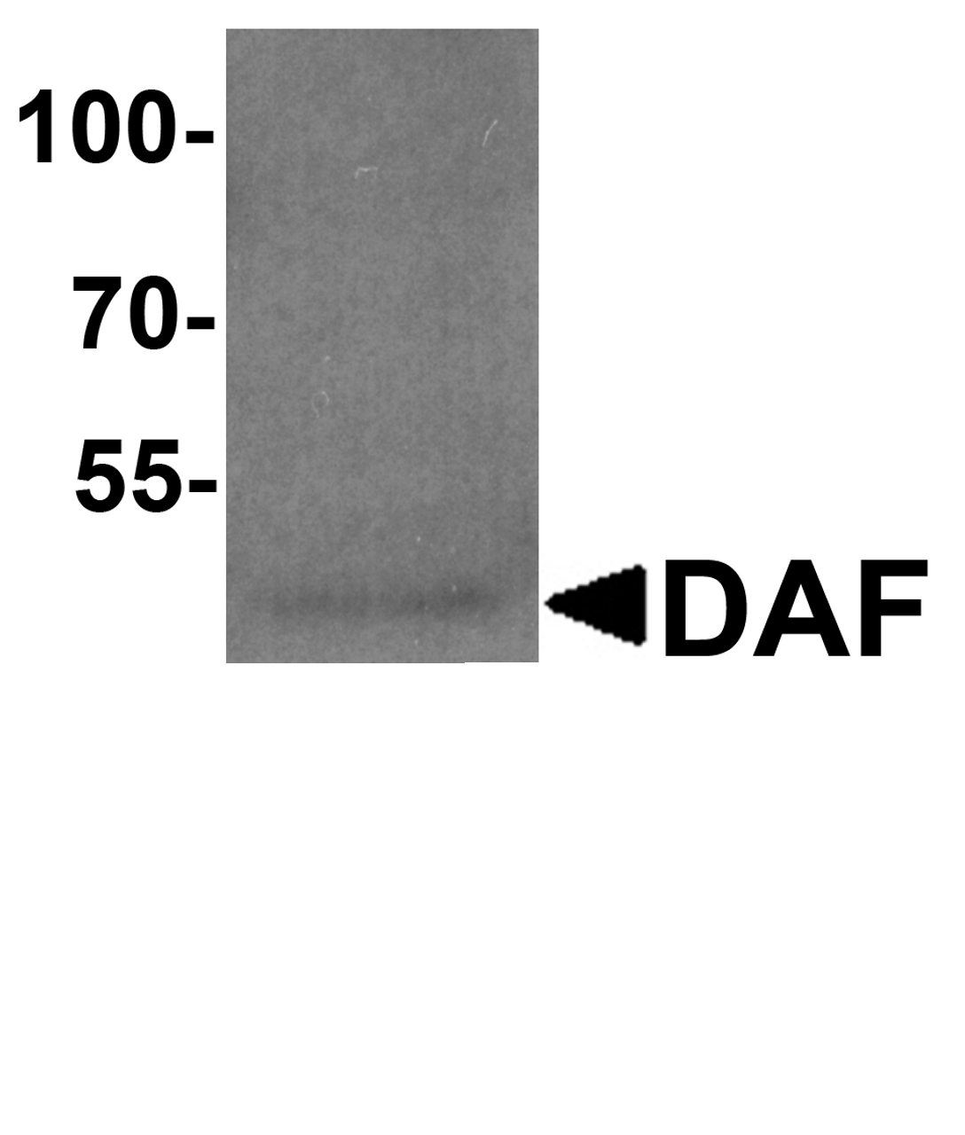 Western blot analysis of DAF in A549 cell lysate with DAF antibody at 1 &#956;g/ml.