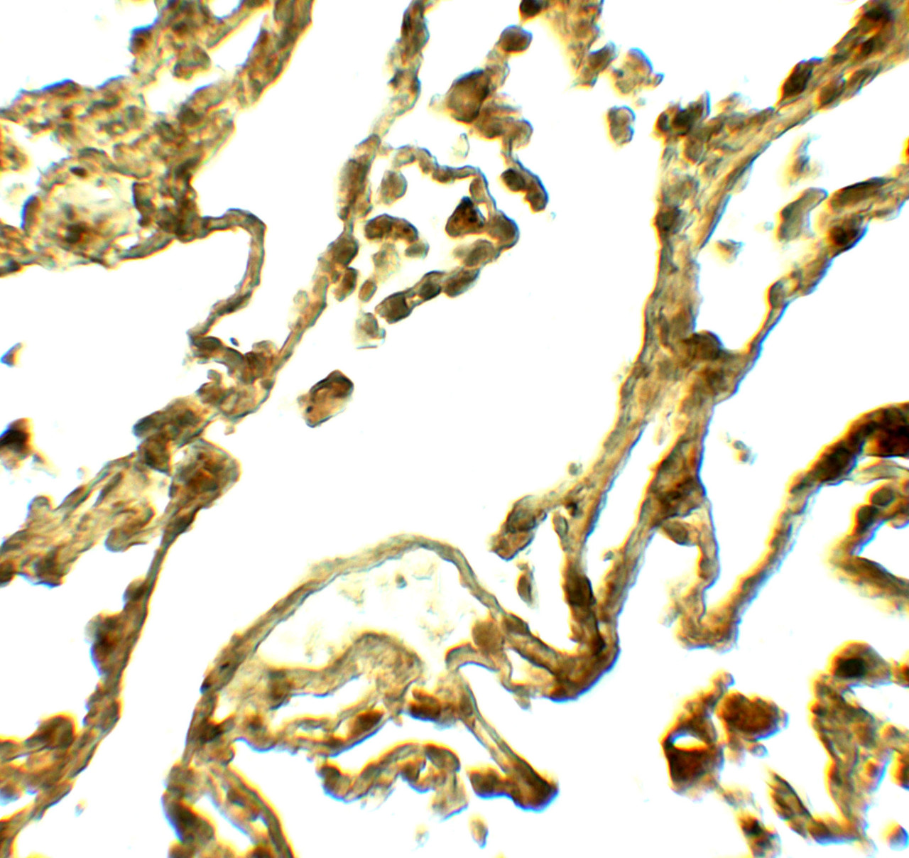 Immunohistochemistry of UVRAG in human lung tissue with UVRAG antibody at 5 ug/ml.