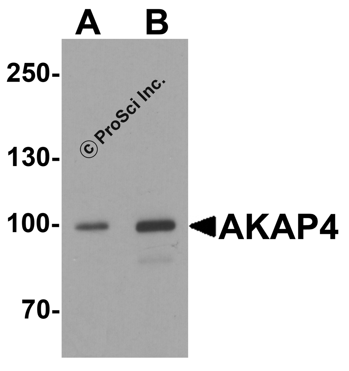 Western blot analysis of AKAP4 in human testis tissue lysate with AKAP4 antibody at (A) 1 and (B) 2 &#956;g/ml.