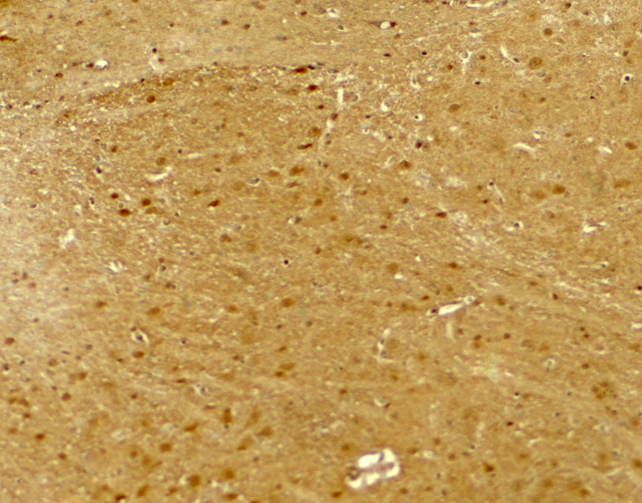 Immunohistochemistry of NLGN2 in mouse brain tissue with NLGN2 antibody at 5 ug/ml.
