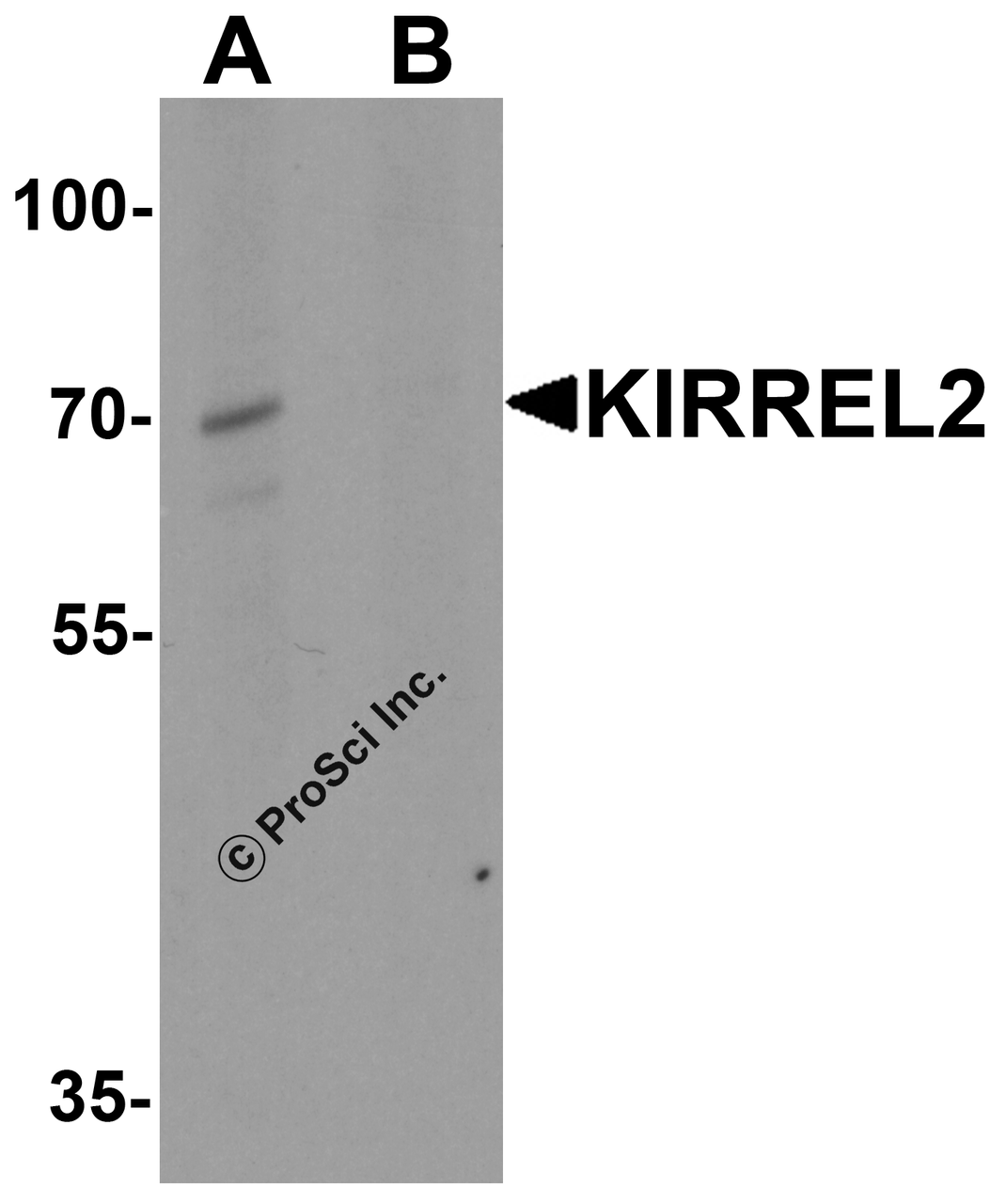 Western blot analysis of KIRREL2 in 293 cell lysate with KIRREL2 antibody at 1 &#956;g/ml in (A) the absence and (B) the presence of blocking peptide.