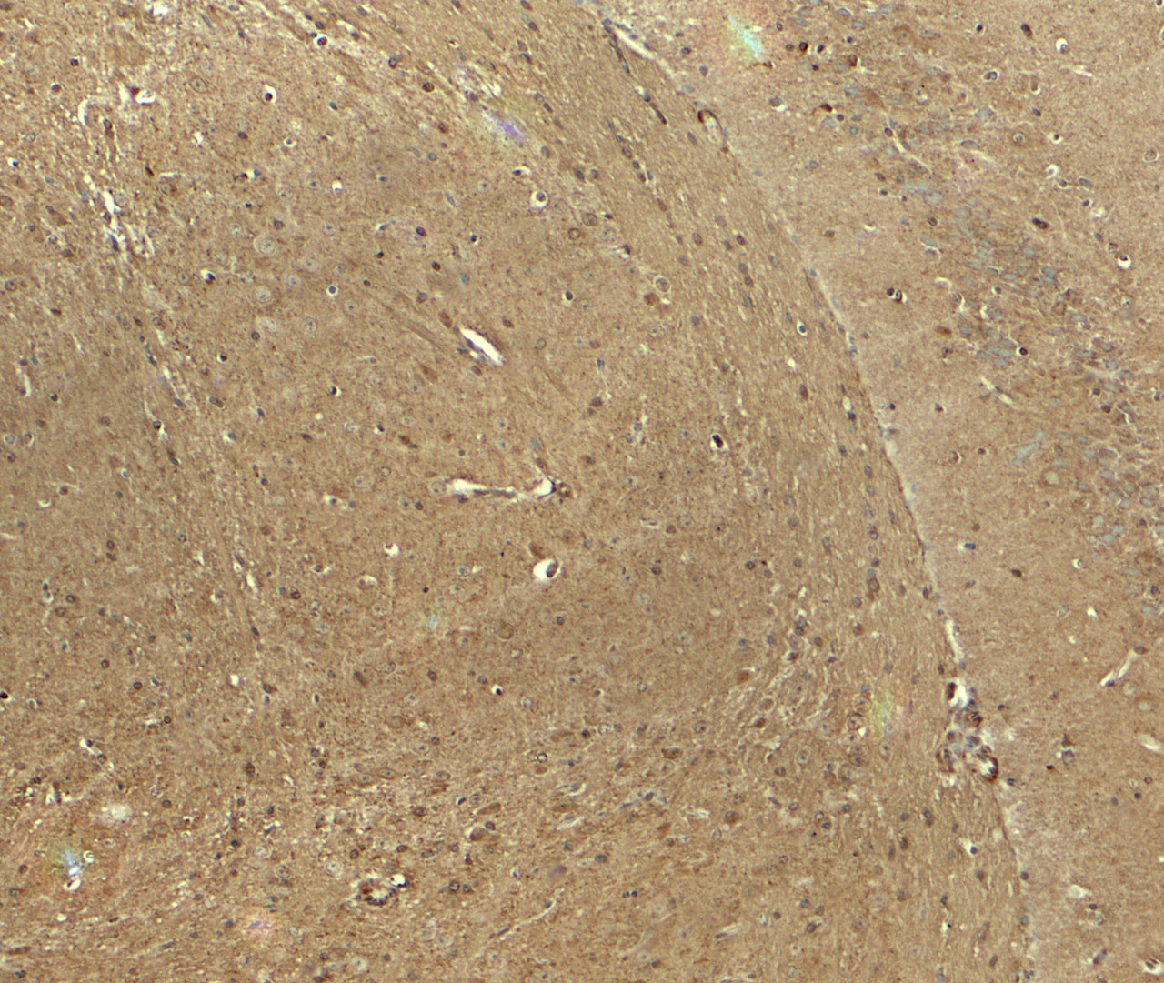 Immunohistochemistry of CADM3 in mouse brain tissue with CADM3 antibody at 5 ug/ml.