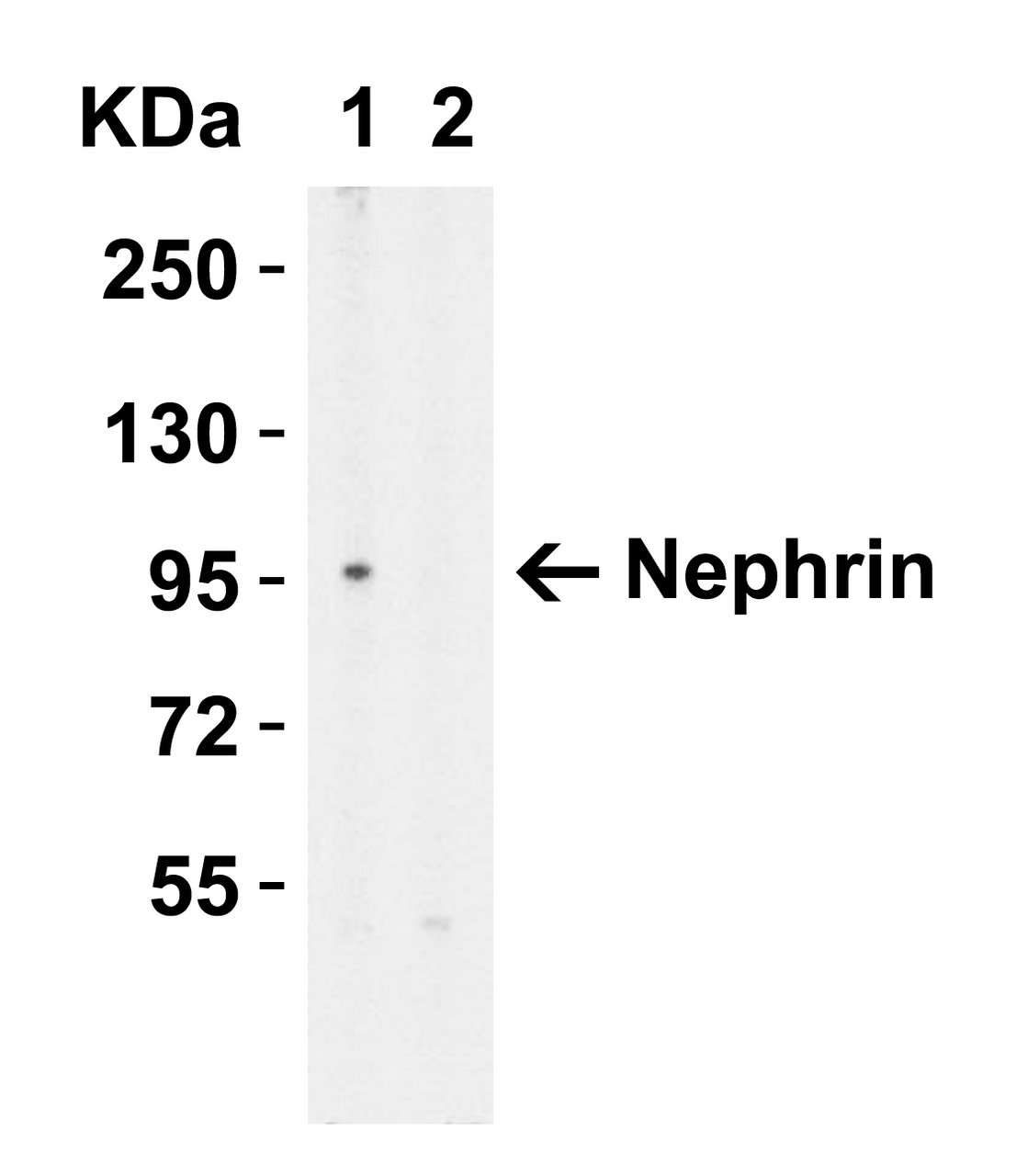 Figure 1 Western Blot Validation in HeLa Cell Lysate with (A) the Absence and (B) the Presence of Blocking Peptide
Loading: 15 &#956;g of lysates per lane.
Antibodies: Nephrin 7979 (1 &#956;g/mL) , 1h incubation at RT in 5% NFDM/TBST.
Secondary: Goat anti-rabbit IgG HRP conjugate at 1:10000 dilution.