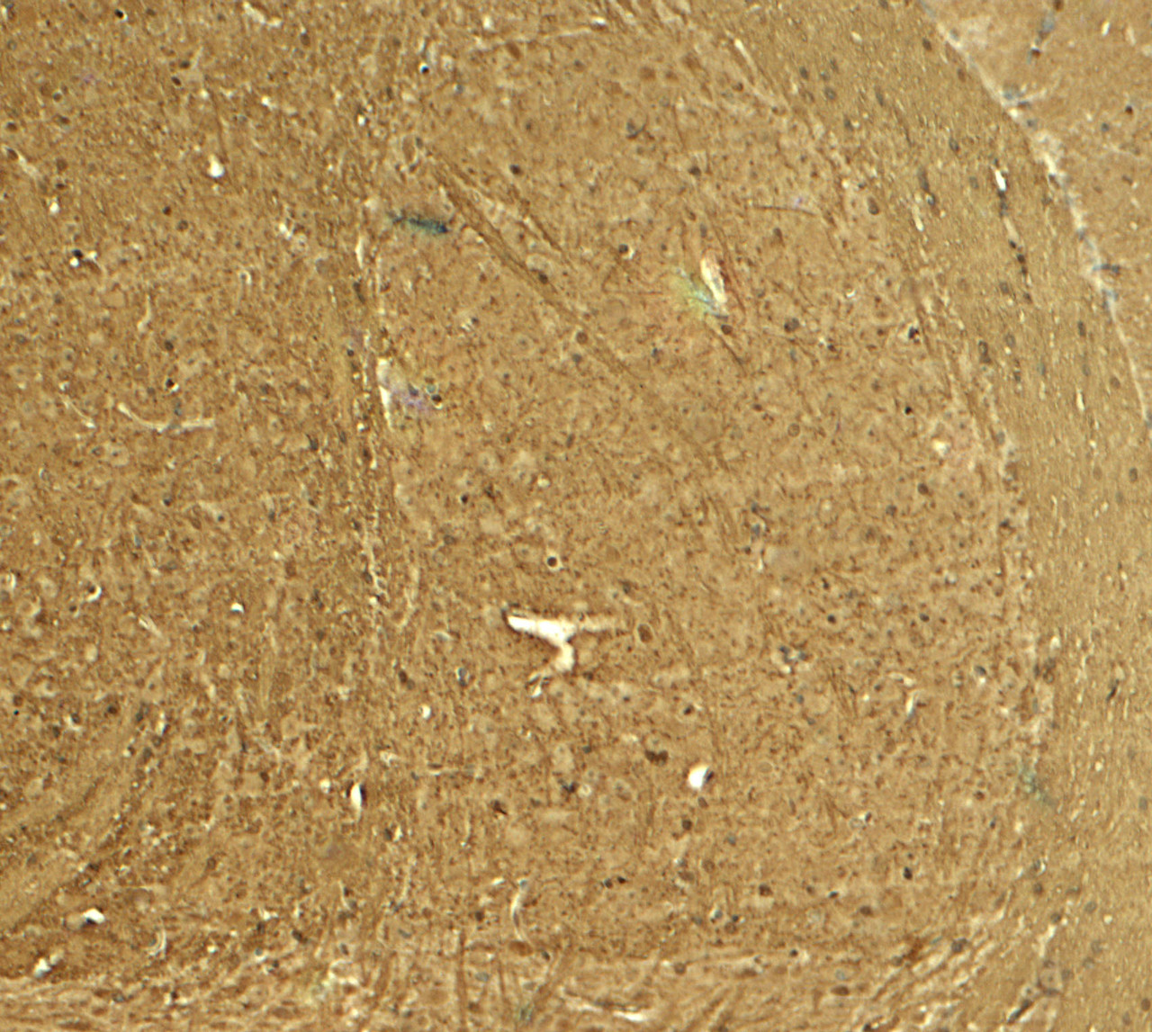 Immunohistochemistry of PTPN5 in mouse brain tissue with PTPN5 antibody at 5 ug/ml.