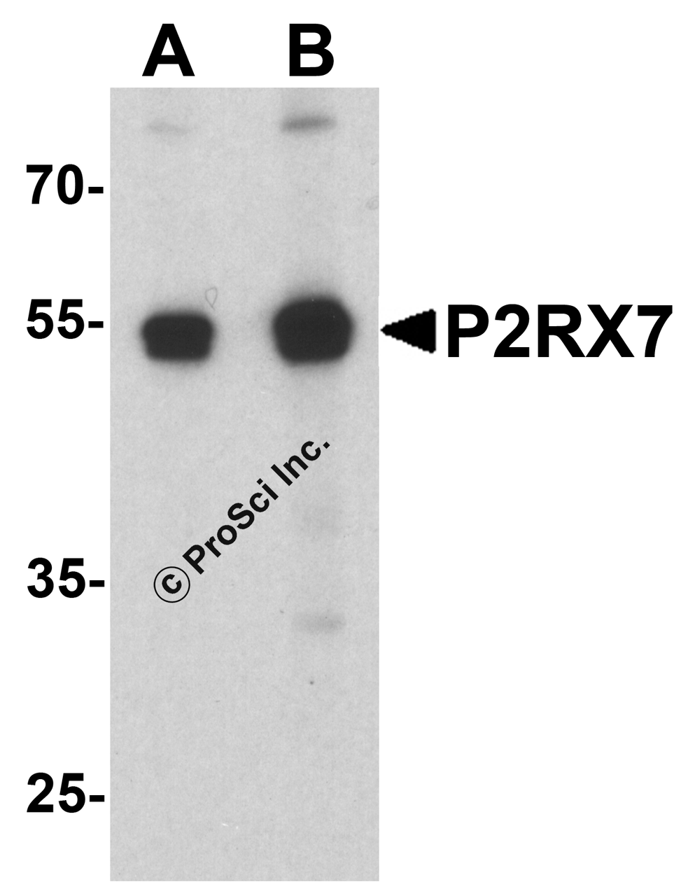 Western blot analysis of P2RX7 in 3T3 cell lysate with P2RX7 antibody at (A) 1 and (B) 2 &#956;g/ml.