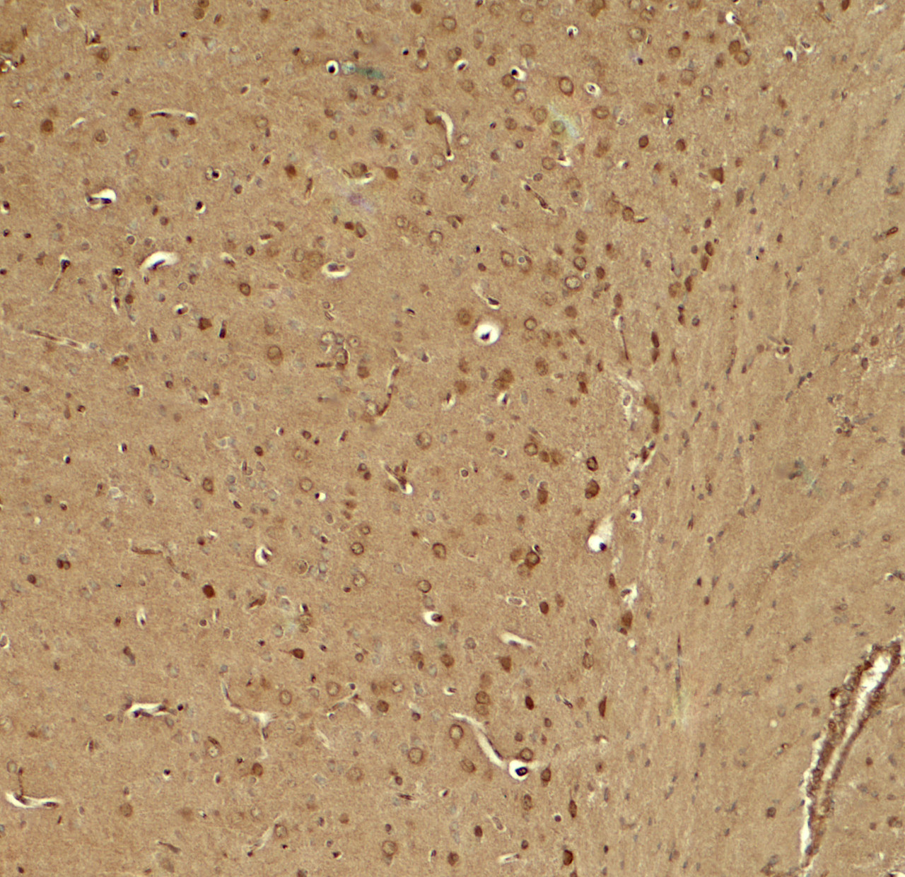 Immunohistochemistry of KCNK1 in mouse brain tissue with KCNK1 antibody at 5 ug/ml.