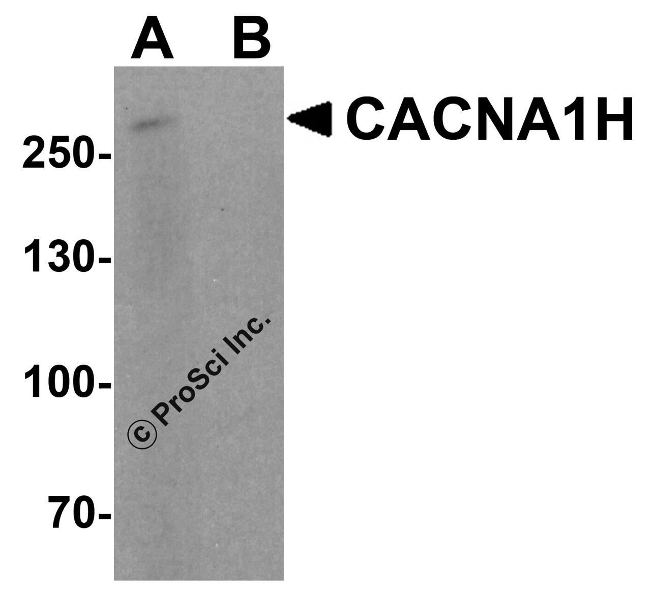 Western blot analysis of CACNA1H in 293 cell lysate with CACNA1H antibody at 1 &#956;g/ml in (A) the absence and (B) the presence of blocking peptide.