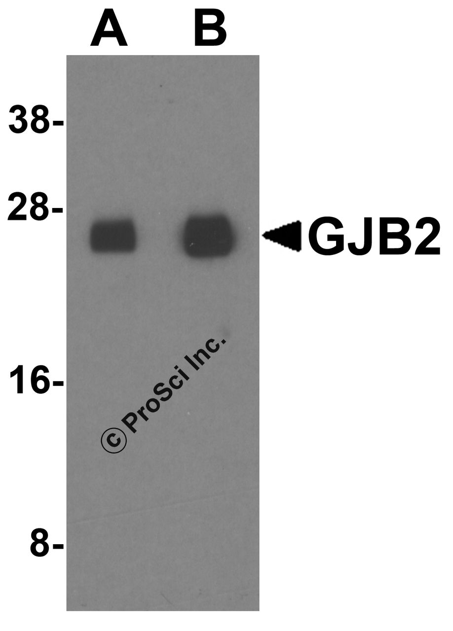 Western blot analysis of GJB2 in human colon tissue lysate with GJB2 antibody at (A) 1 and (B) 2 &#956;g/ml.