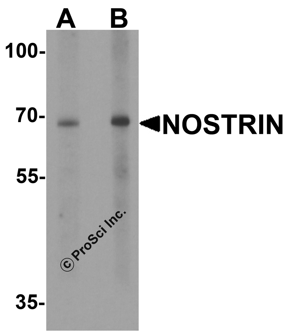 Western blot analysis of NOSTRIN in SW480 cell lysate with NOSTRIN antibody at (A) 1 and (B) 2 &#956;g/ml.