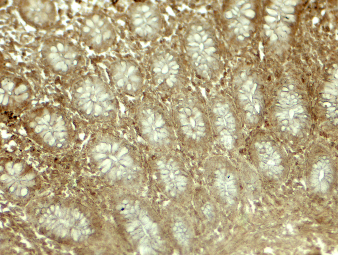 Immunohistochemistry of LIMA1 in human colon tissue with LIMA1 antibody at 5 ug/mL.