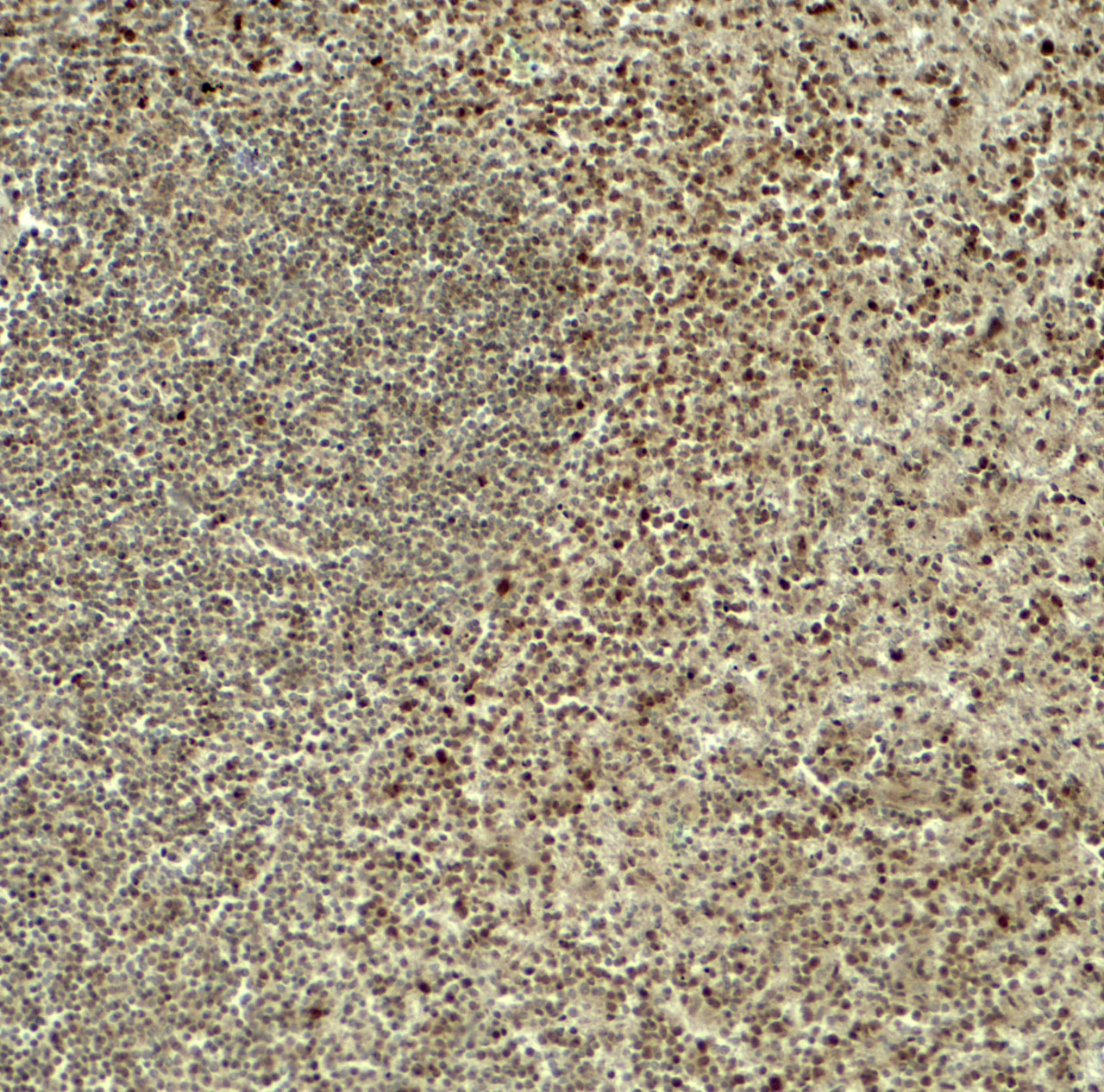 Immunohistochemistry of HES5 in human spleen tissue with HES5 antibody at 5 ug/ml.