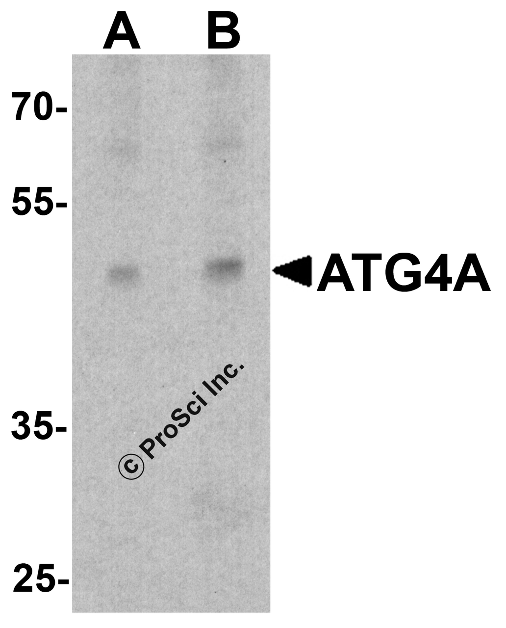 Western blot analysis of ATG4A in EL4 cell lysate with ATG4A antibody at (A) 1 and (B) 2 &#956;g/ml.
