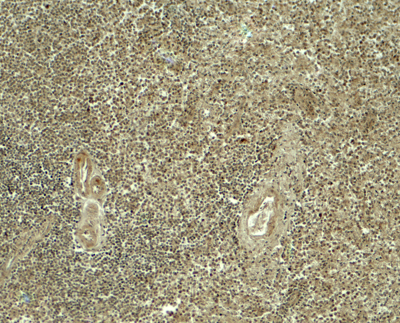 Immunohistochemistry of ATG4A in human spleen tissue with ATG4A antibody at 5 ug/ml.