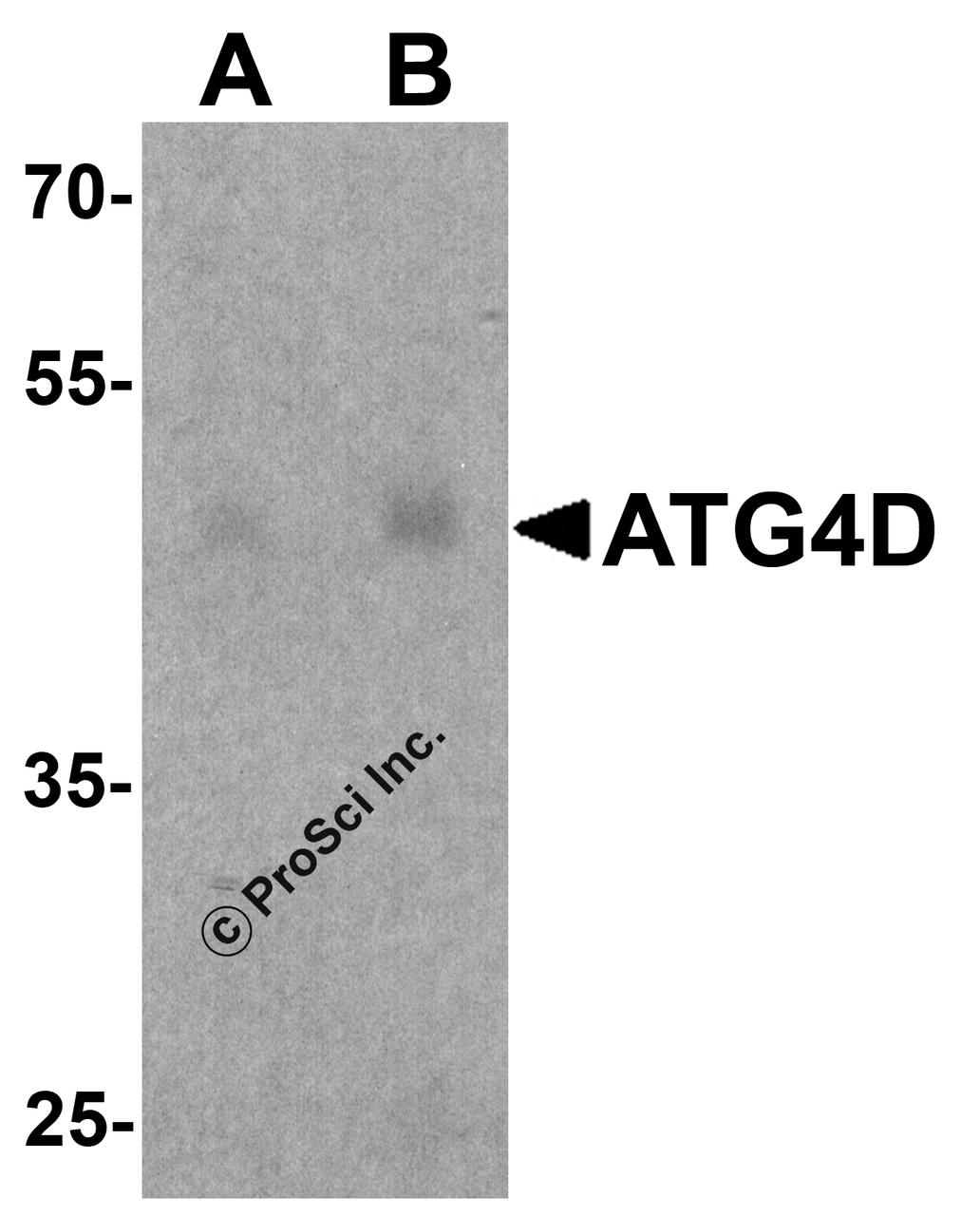 Western blot analysis of ATG4D in human testis tissue lysate with ATG4D antibody at (A) 1 and (B) 2 &#956;g/ml.