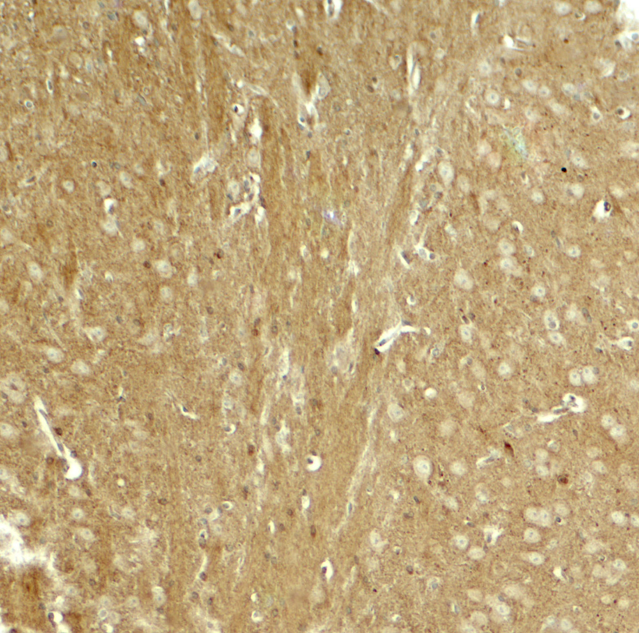 Immunohistochemistry of TAU in mouse brain tissue with TAU antibody at 5 ug/ml.