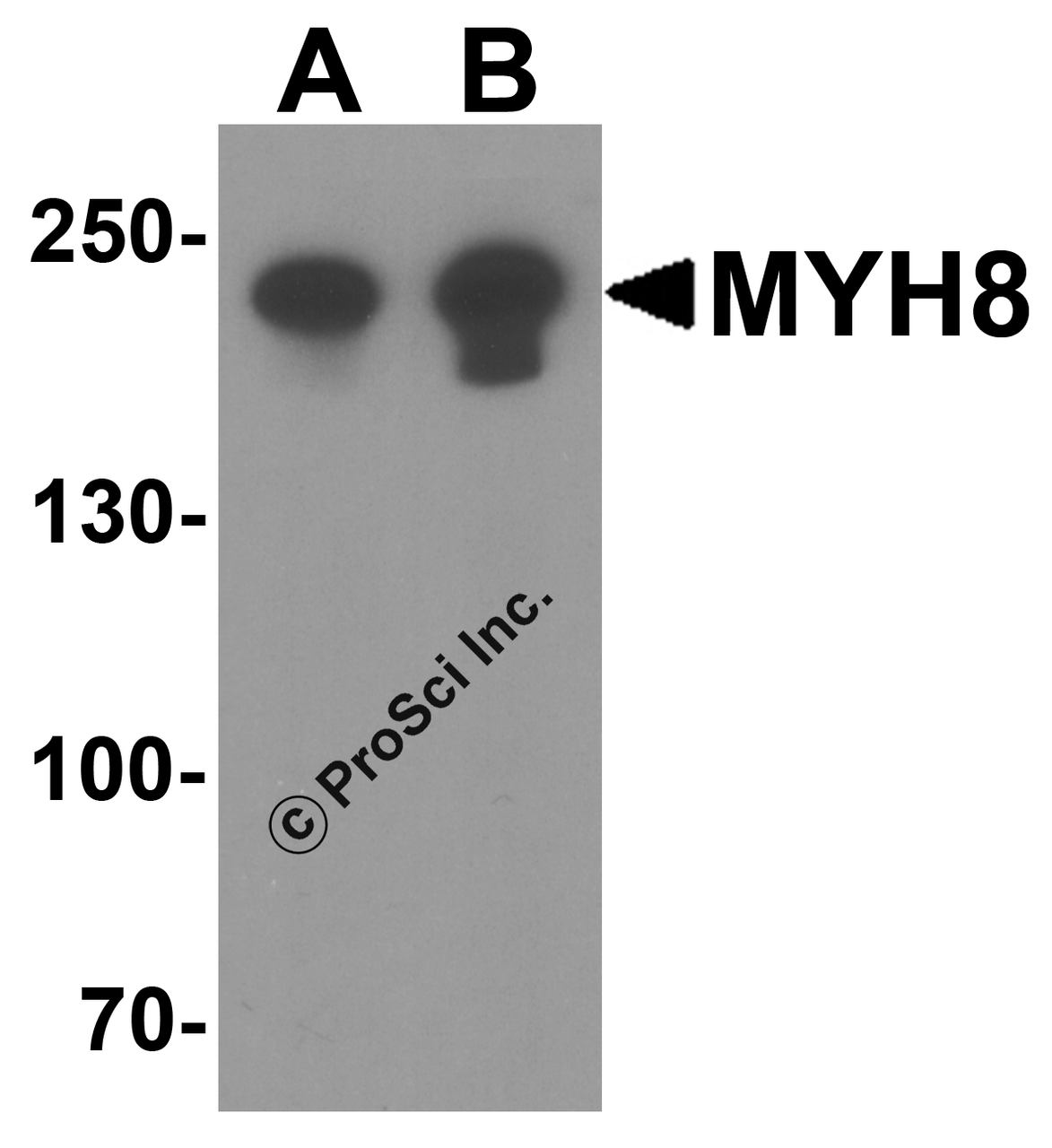 Western blot analysis of MYH8 in HeLa cell lysate with MYH8 antibody at (A) 0.5 and (B) 1 &#956;g/ml.