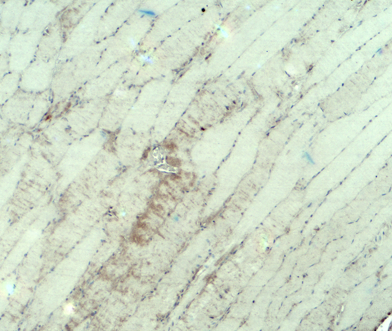 Immunohistochemistry of MYH3 in mouse skeletal muscle tissue with MYH3 antibody at 5 ug/ml.