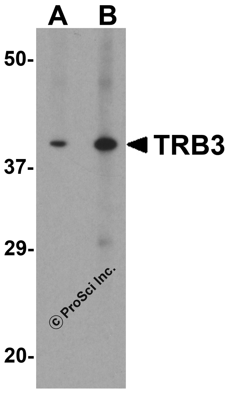 Western blot analysis of TRB3 in mouse kidney tissue lysate with TRB3 antibody at (A) 1 and (B) 2 &#956;g/ml.