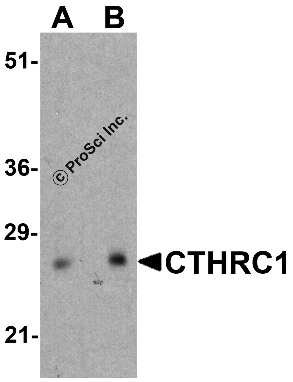 Western blot analysis of CTHRC1 in rat small intestine tissue lysate with CTHRC1 antibody at (A) 1 and (B) 2 &#956;g/ml.