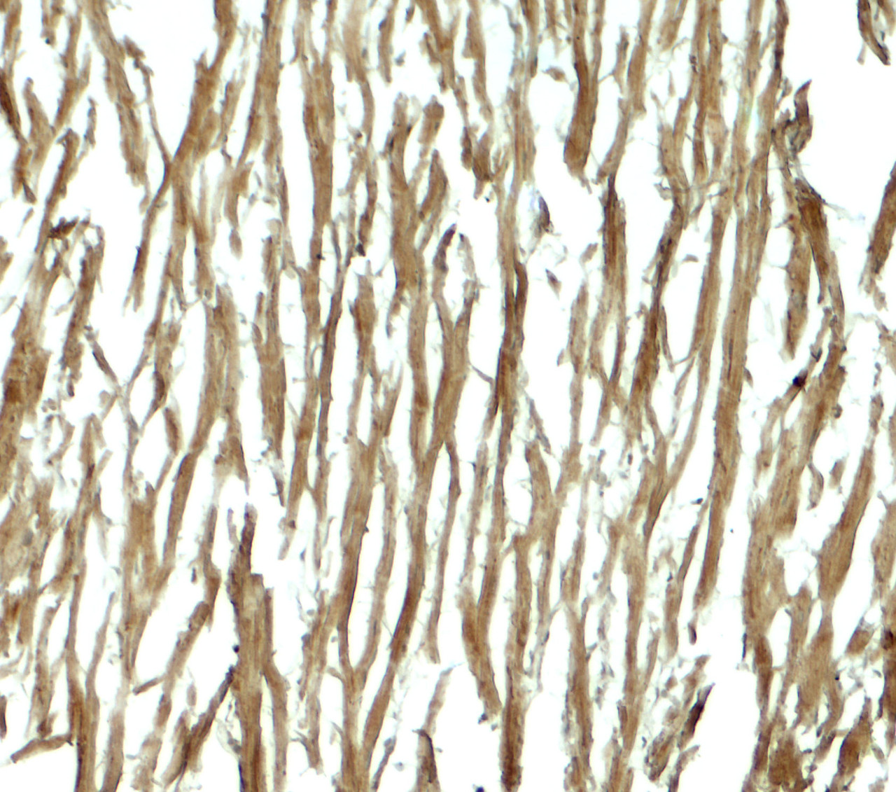 Immunohistochemistry of DNAJC13 in human heart tissue with DNAJC13 antibody at 5 ug/mL.