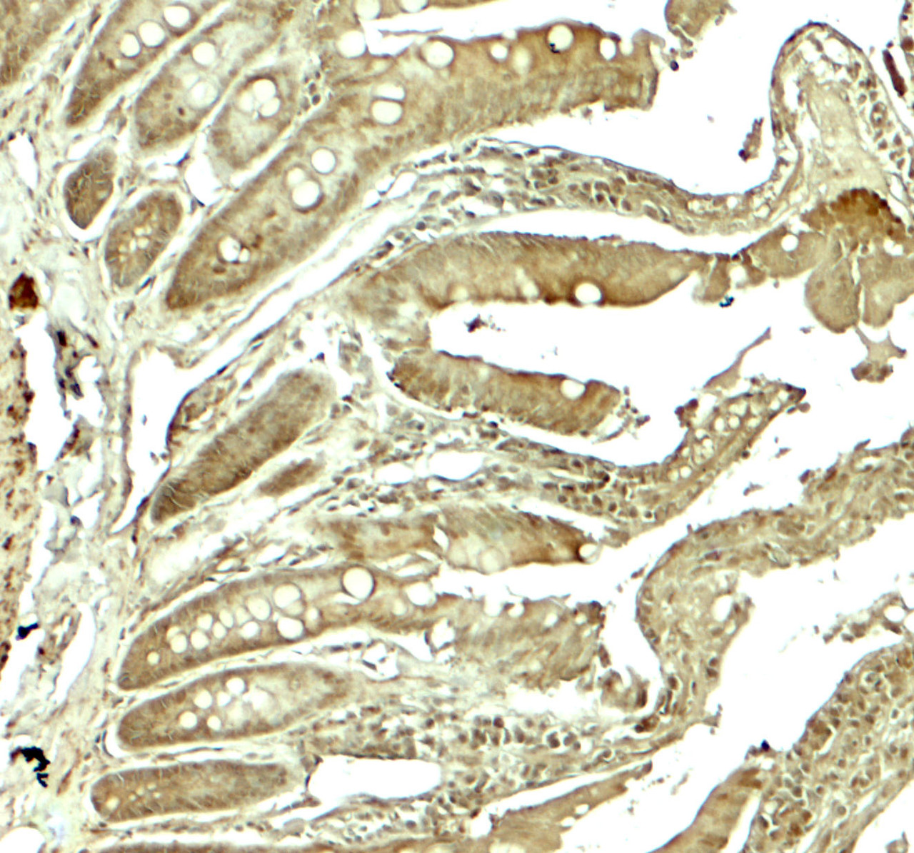 Immunohistochemistry of ADORA2B in rat colon tissue with ADORA2B antibody at 5 ug/mL.